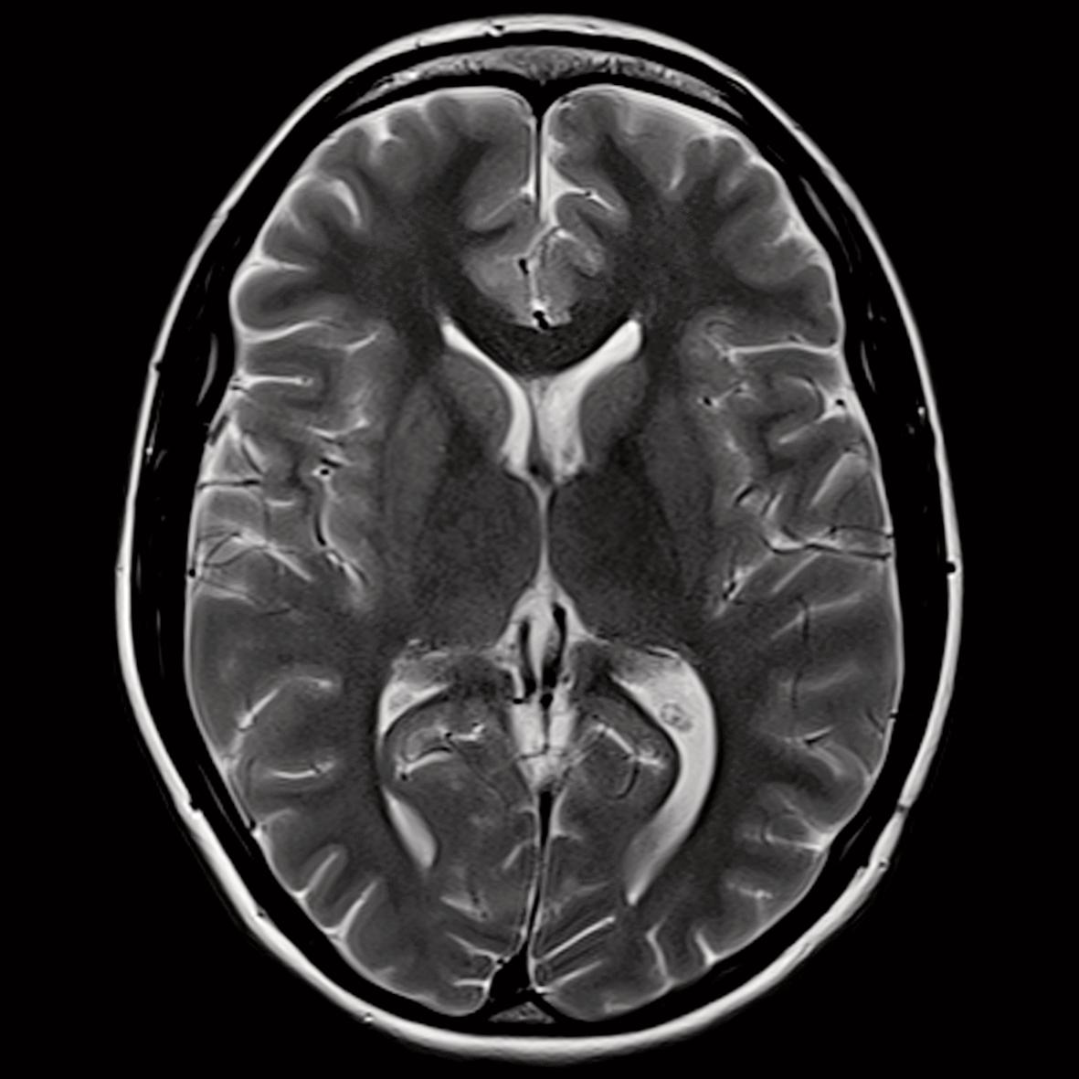 Brain health and neuroplasticity illustration