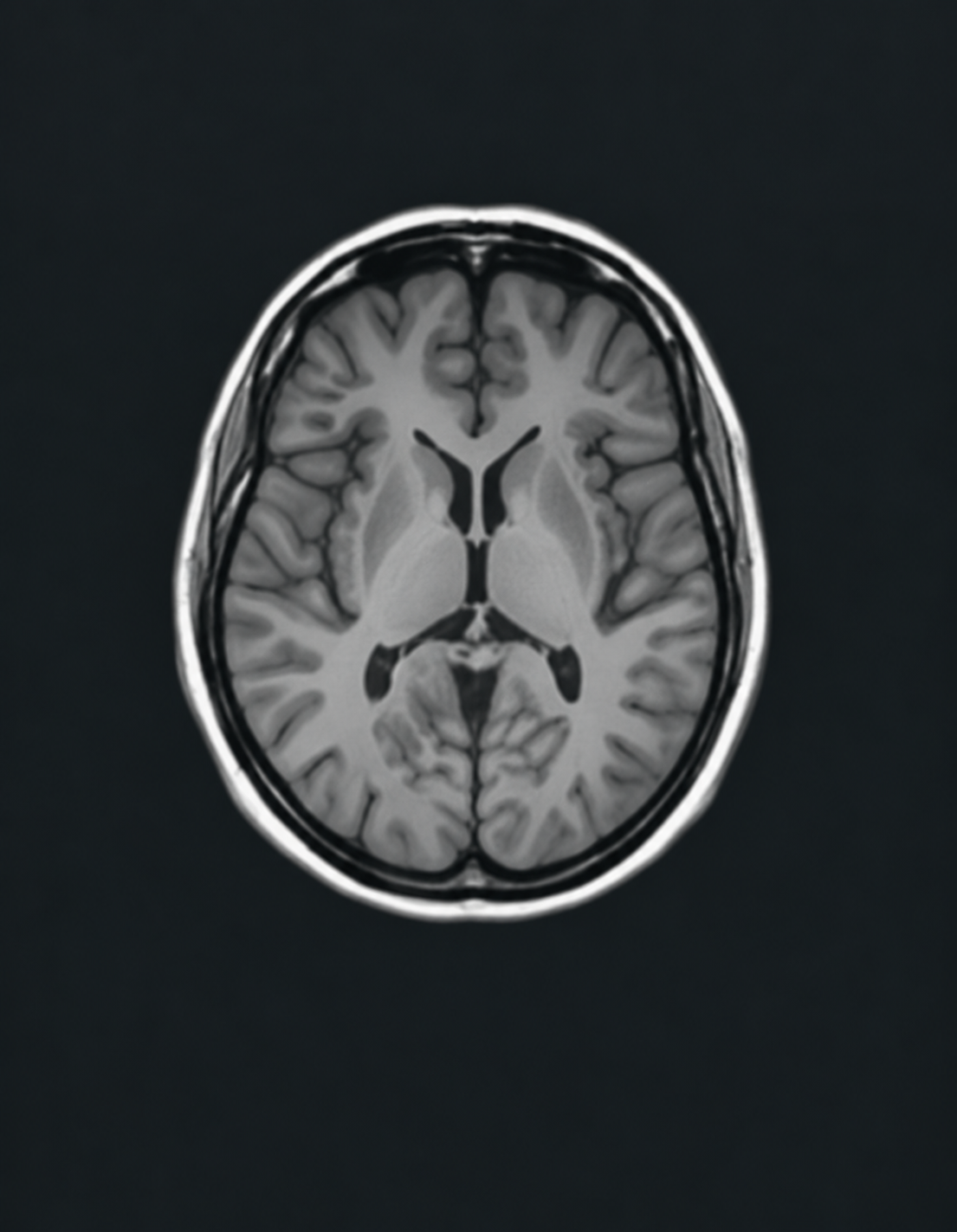 Neurological diagnostics