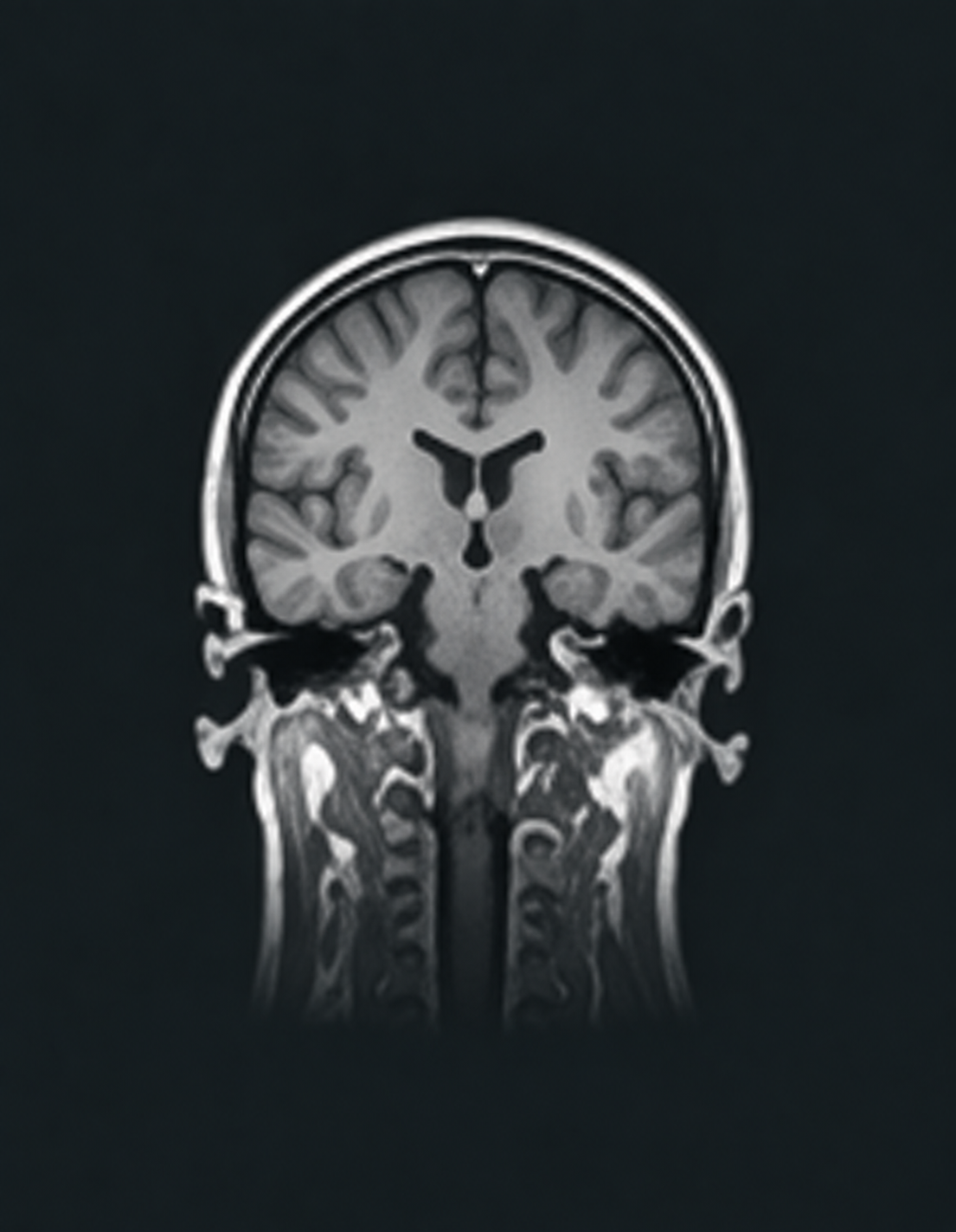 Brain imaging scan